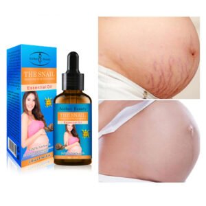 Stretch mark oil