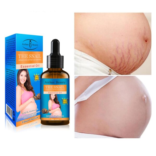 D694306C-E897-4A35-8D87-13EBEE21EFAC.jpeg Stretch mark oil